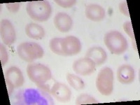 image of blood_cell