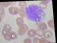 image of blood_cell