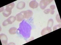 image of blood_cell