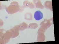 image of blood_cell