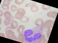 image of blood_cell