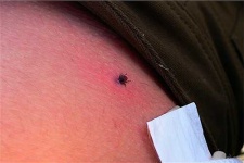 image of tick