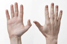 image of Hand