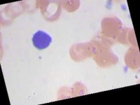 image of blood_cell