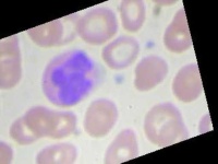 image of blood_cell