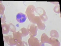 image of blood_cell