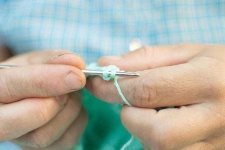 image of stitches