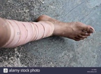 image of bandage