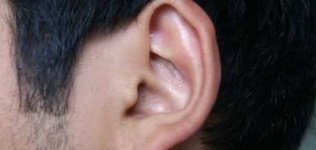 image of ear
