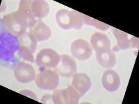 image of blood_cell
