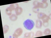 image of blood_cell