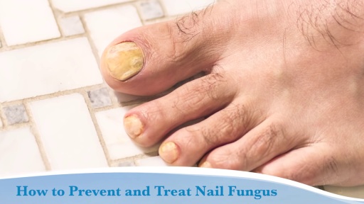 image of nail_disease #16