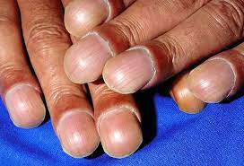 image of nails #0