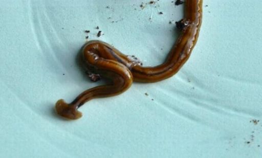 image of parasitic_flatworms #14