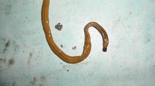 image of parasitic_flatworms #21