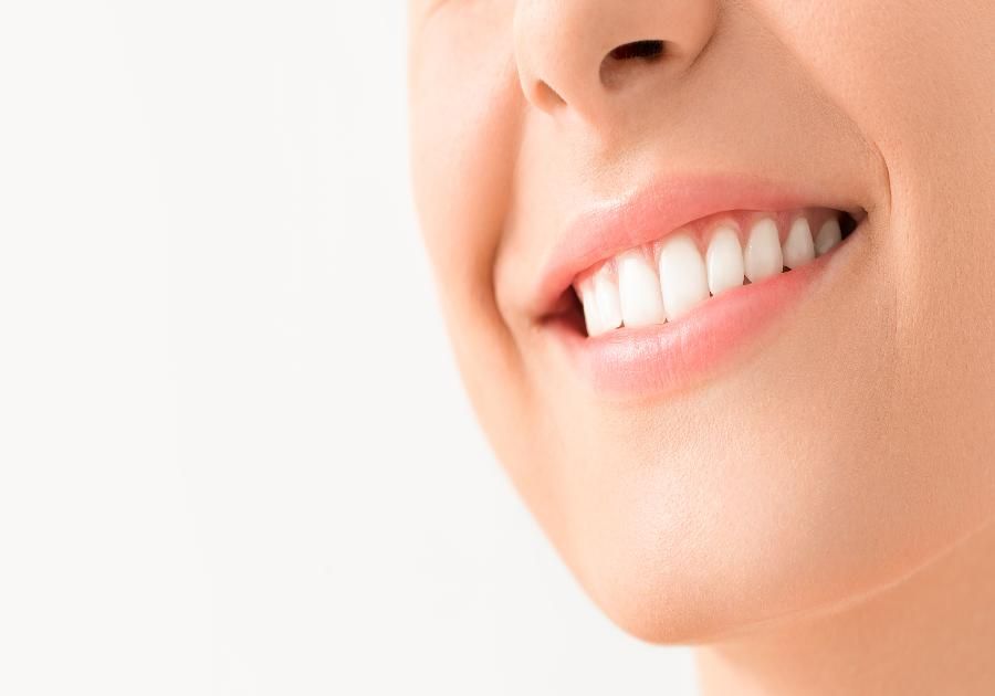 Qué son las carillas dentales y para qué se utilizan