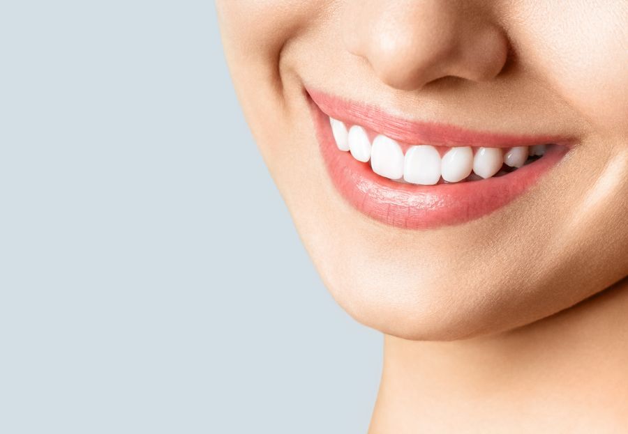 Cinco cosas que debes saber sobre implantes dentales