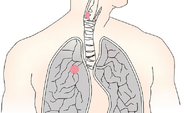 ¿Pueden afectar las humedades a mi salud?