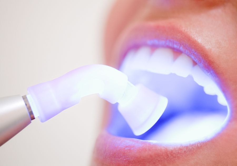 Cuidados tras un blanqueamiento dental