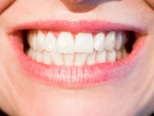 ¿Por qué varía el color de nuestros dientes?