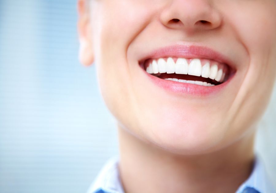 Beneficios del blanqueamiento dental