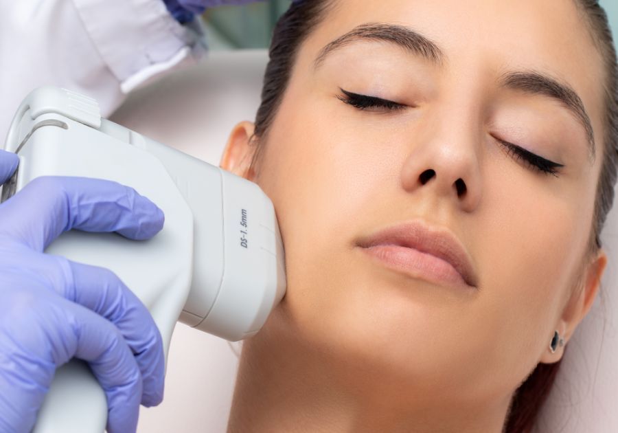 ¿Qué es el fotorejuvenecimiento con IPL?