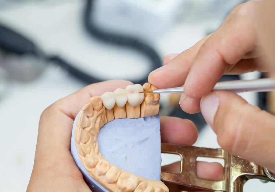 Descubre la cerámica dental