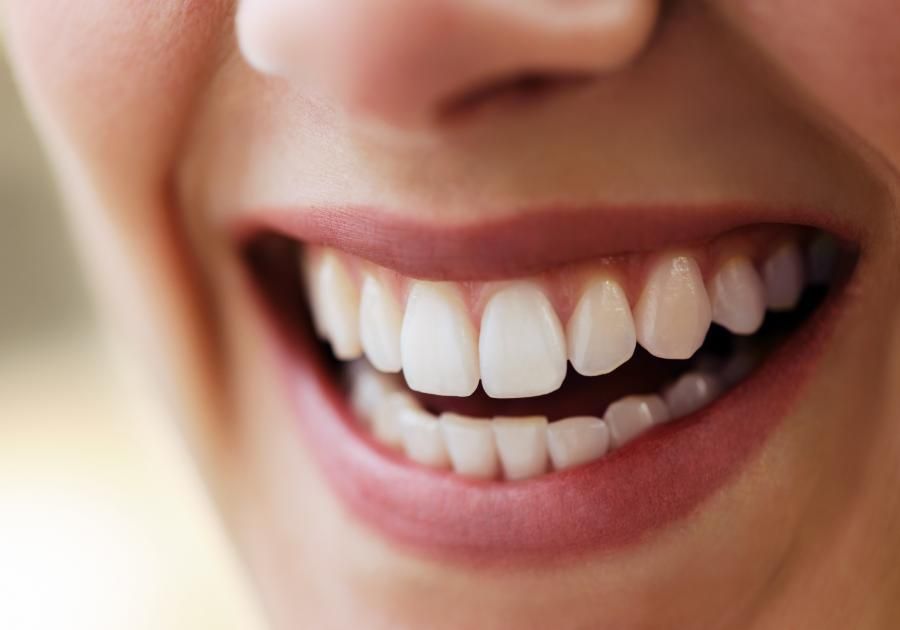 La importancia de tener unos dientes perfectos
