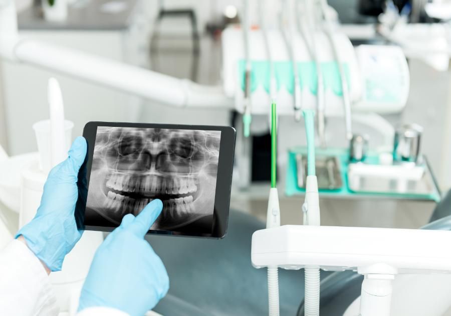 Cómo funcionan los rayos X dentales