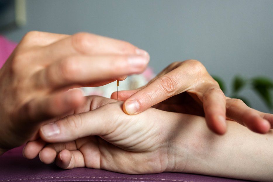 Beneficios que ofrece la punción seca en fisioterapia