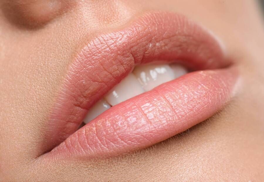 Consigue una boca más sensual con un aumento de labios