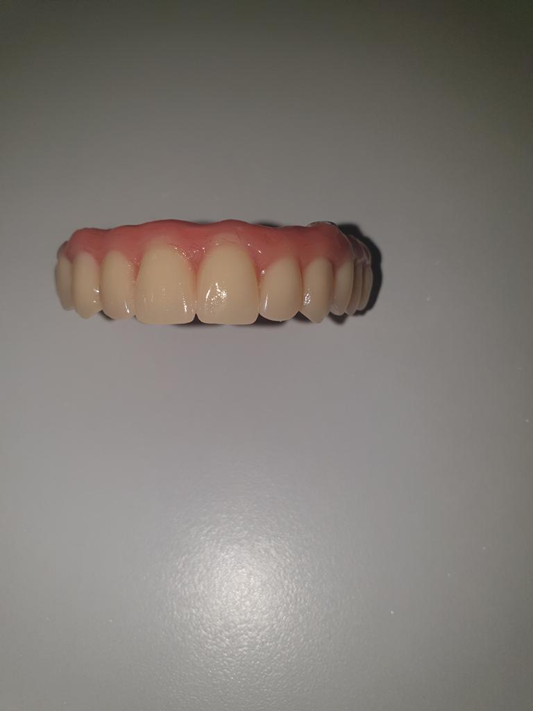 Cambio de dientes en hibrida