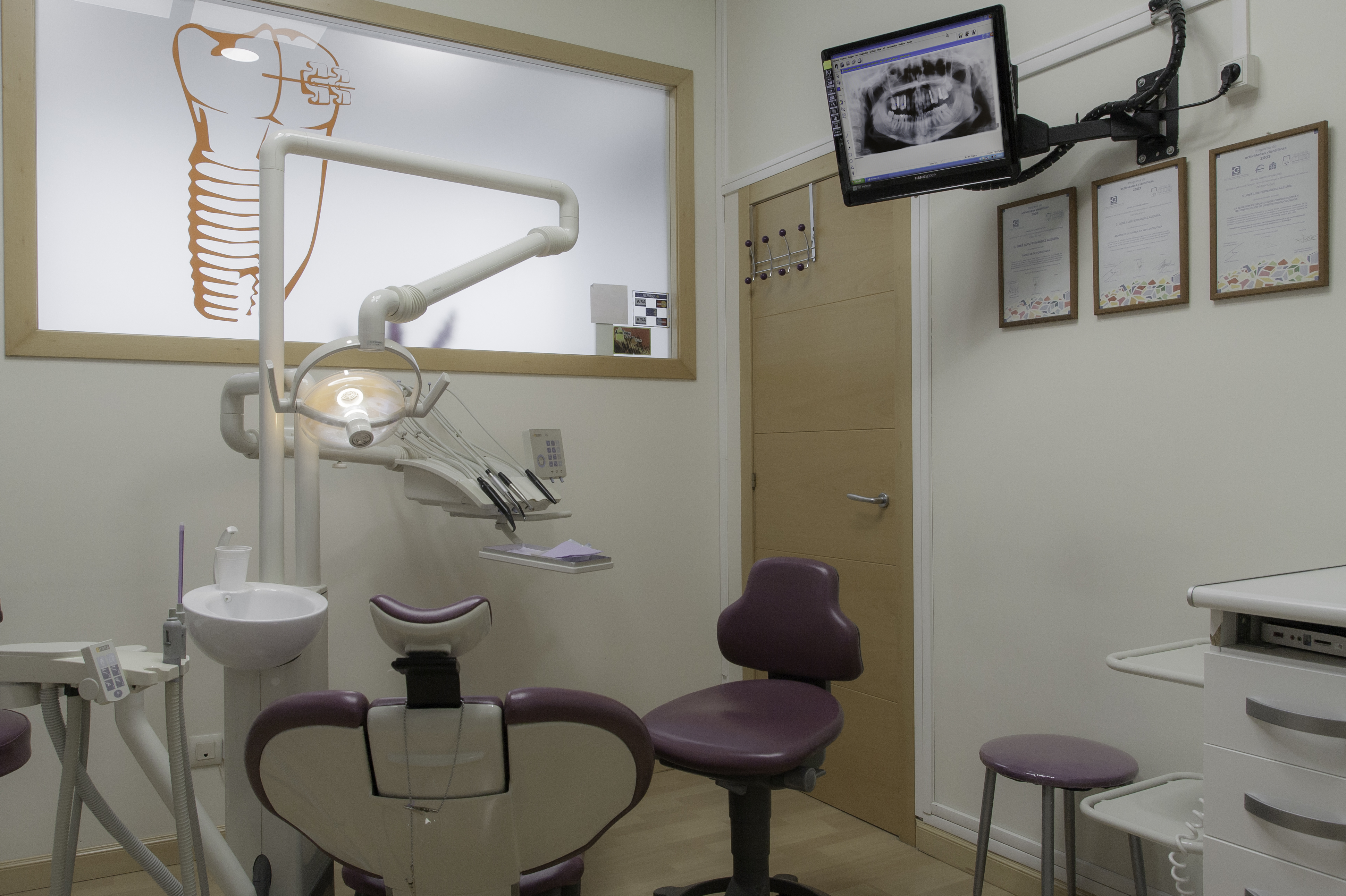 Clínica de implantes dentales en Gijón