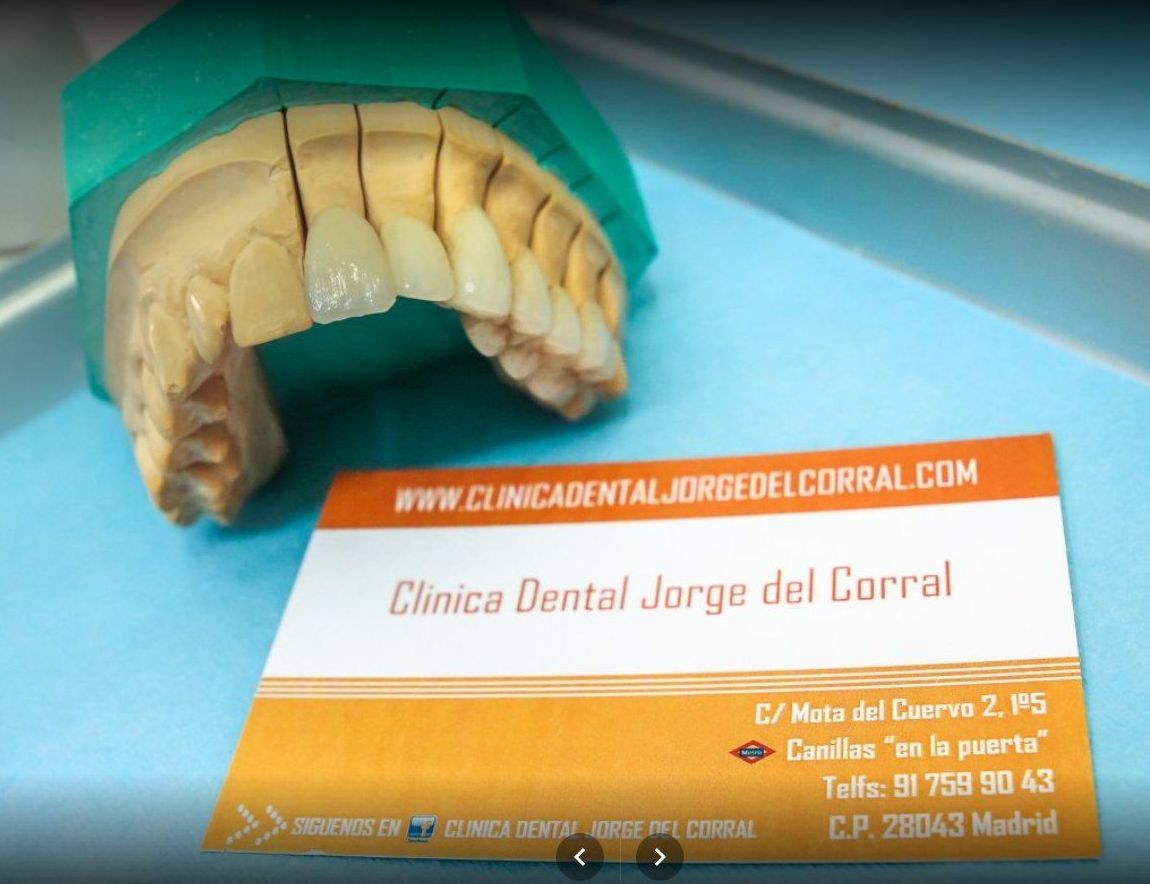 Implantes dentales en hortaleza