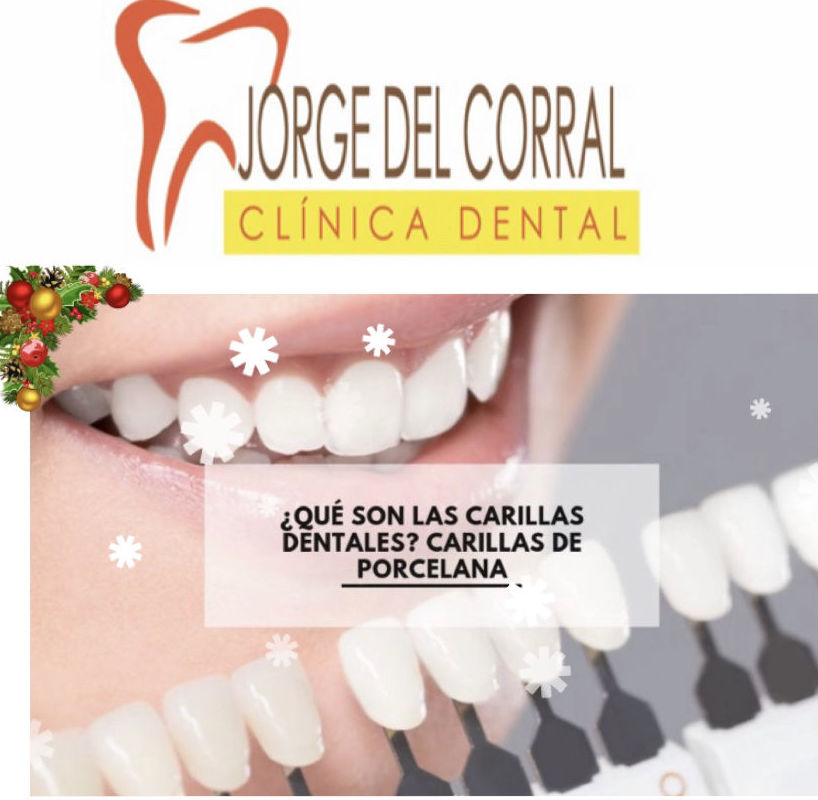 Clínica dental Jorge del Corral Madrid: Carillas dentales,implantes,estética dental,ortodoncia