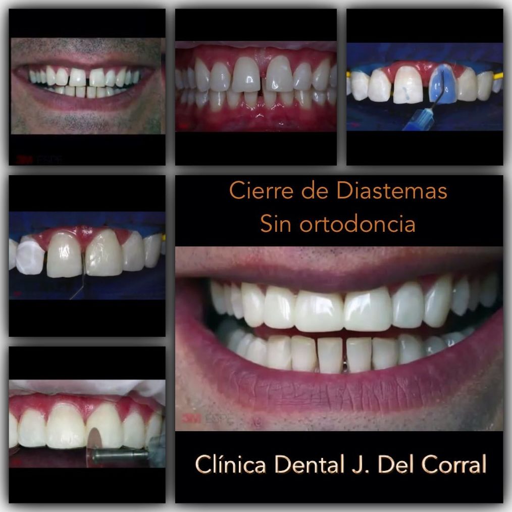 Dentista hortaleza, clínica dental hortaleza.