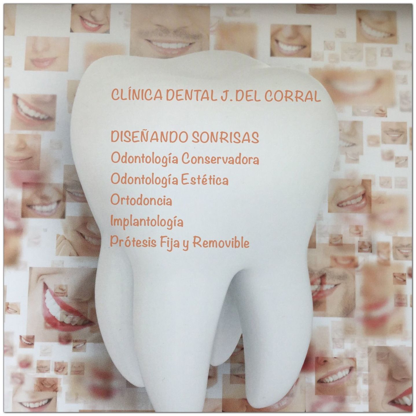 clínica dental Madrid,dentistas en Madrid,prótesis dentales madrid,prótesis fija,prótesis removible,prótesis dentales hortaleza,implantología,ortodoncia Madrid,odontología estética.