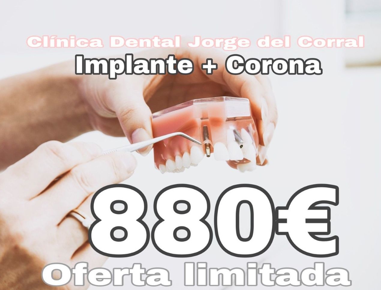 implante dental,hortaleza,canillas,barajas,canillejas,san blas,