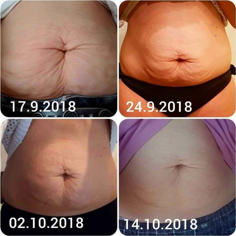 resultado espectacular