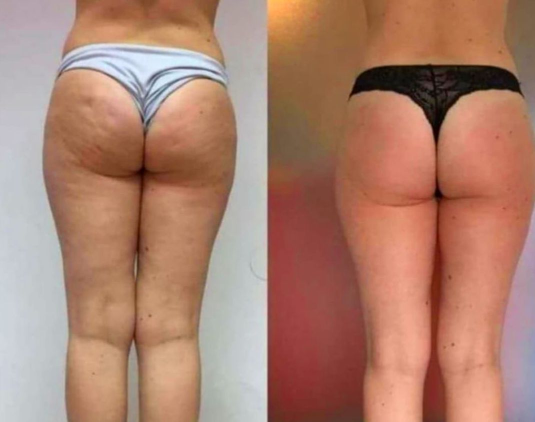 quieres un resultado asi? contáctanos¡¡
