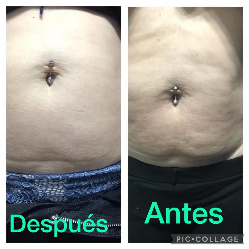 mejora tu tejido adiposo con constancia