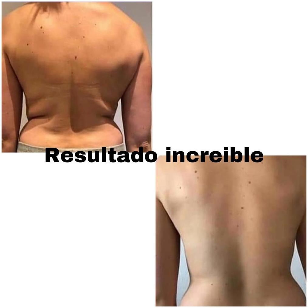 La constancia con nuestra crema, te da alegrias como esta