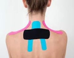 Kinesiotape ¿Qué es y cómo funciona?