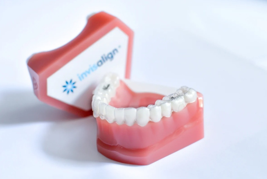 Invisalign, la ortodoncia invisible sin Brackets