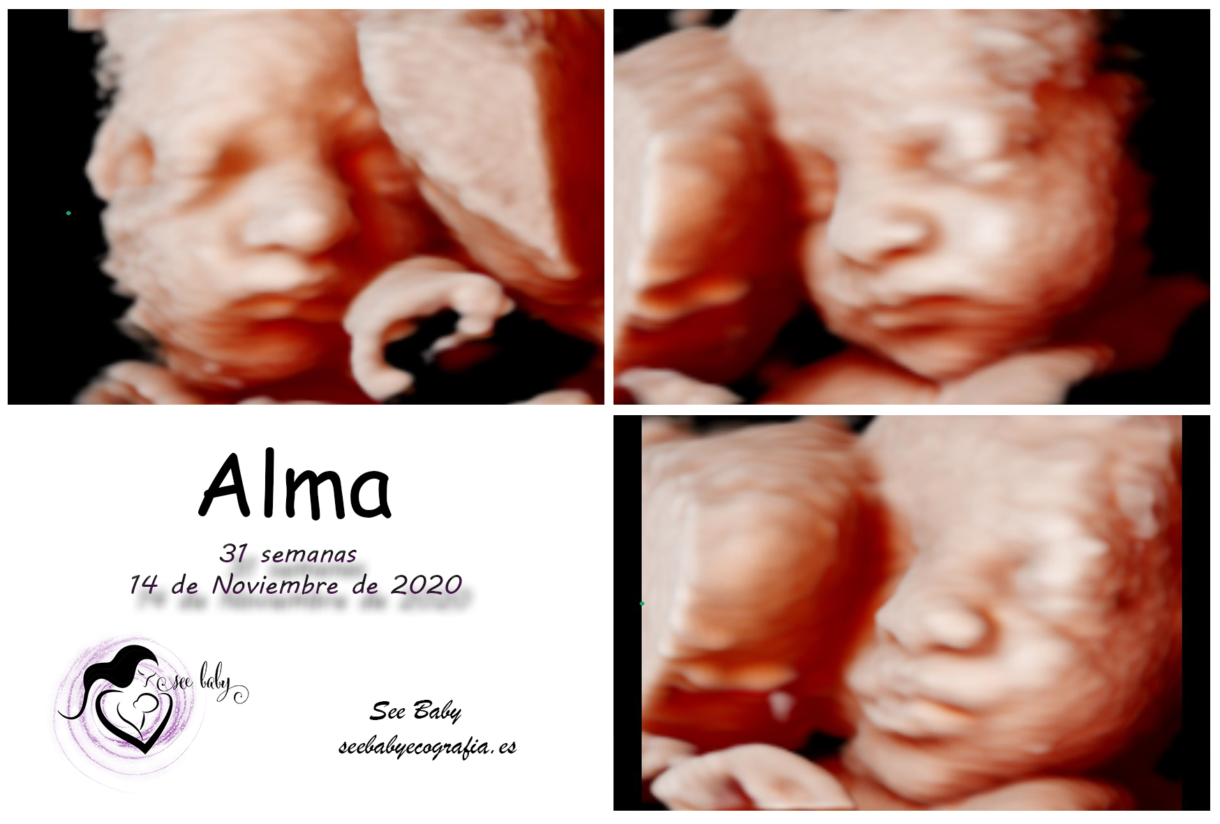 Querida Alma en SeeBaby Ecografia 5D