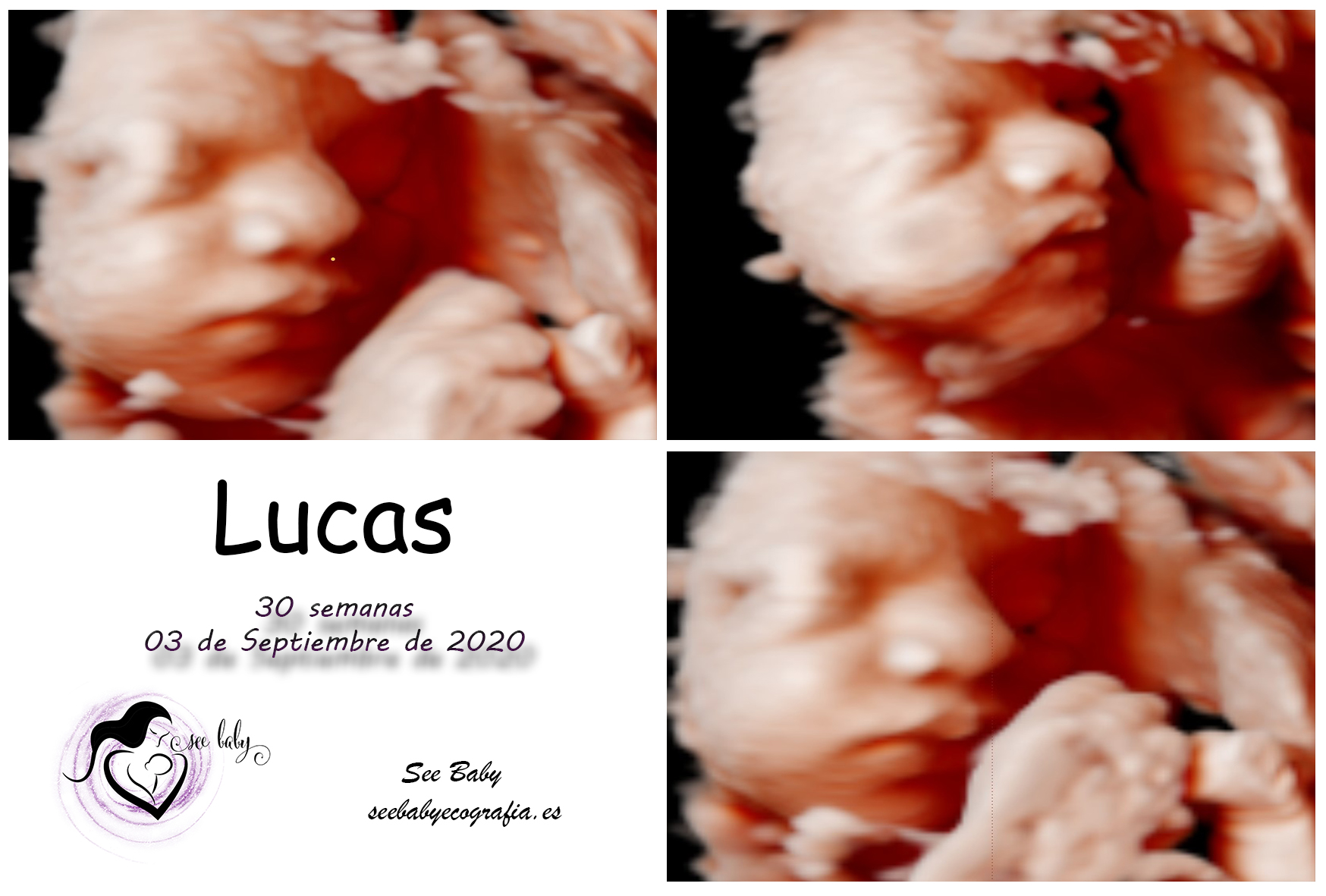 Querido Lucas en SeeBaby Ecografia 5D