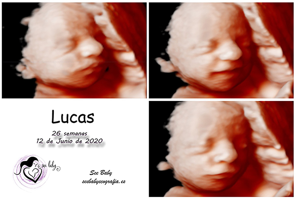 Querido Lucas en SeeBaby Ecografia 5D