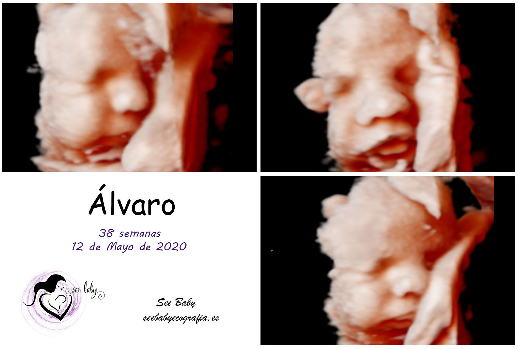 Querido Álvaro en SeeBaby Ecografias 5D