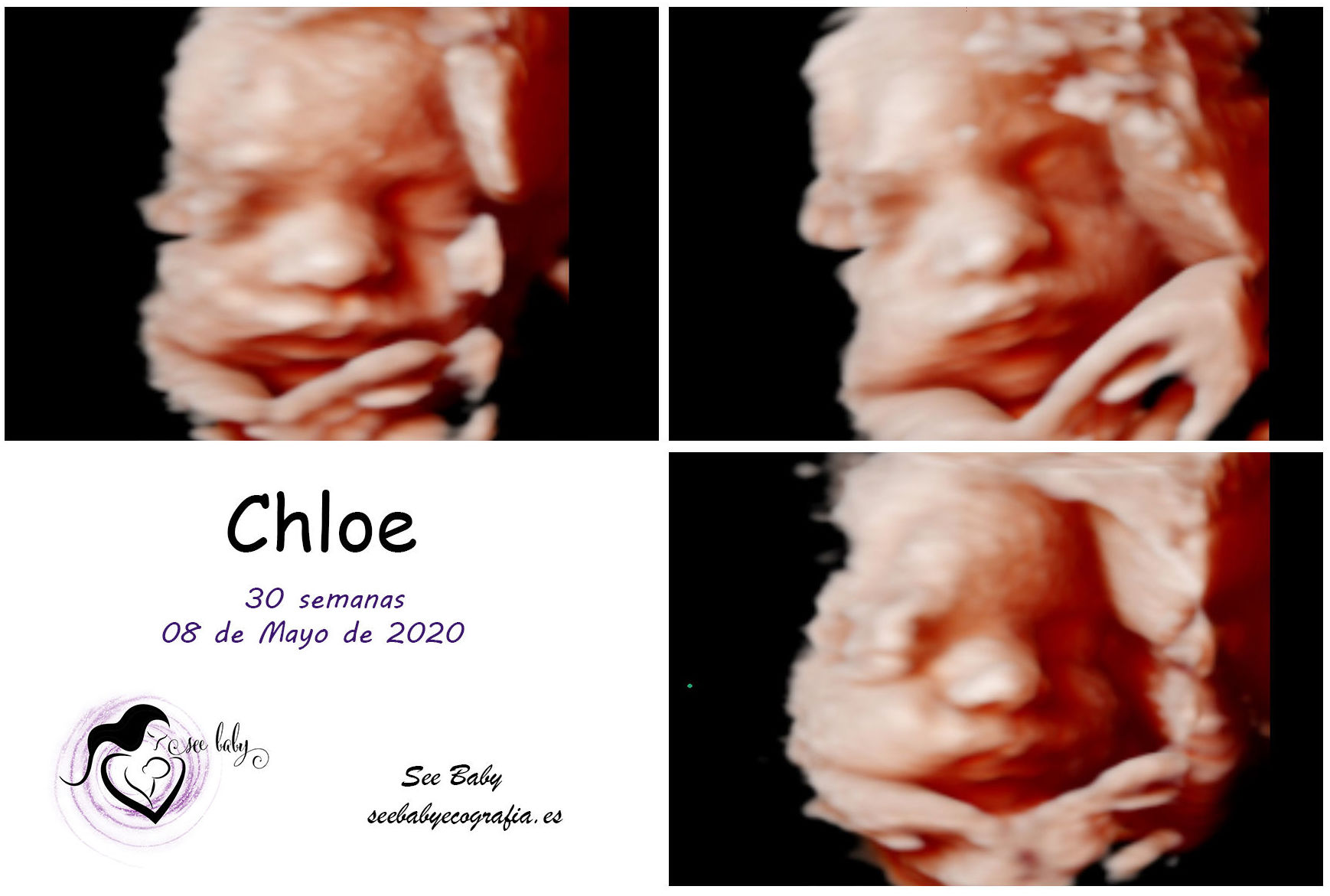 Querida Chloe en SeeBaby Ecografia 5D