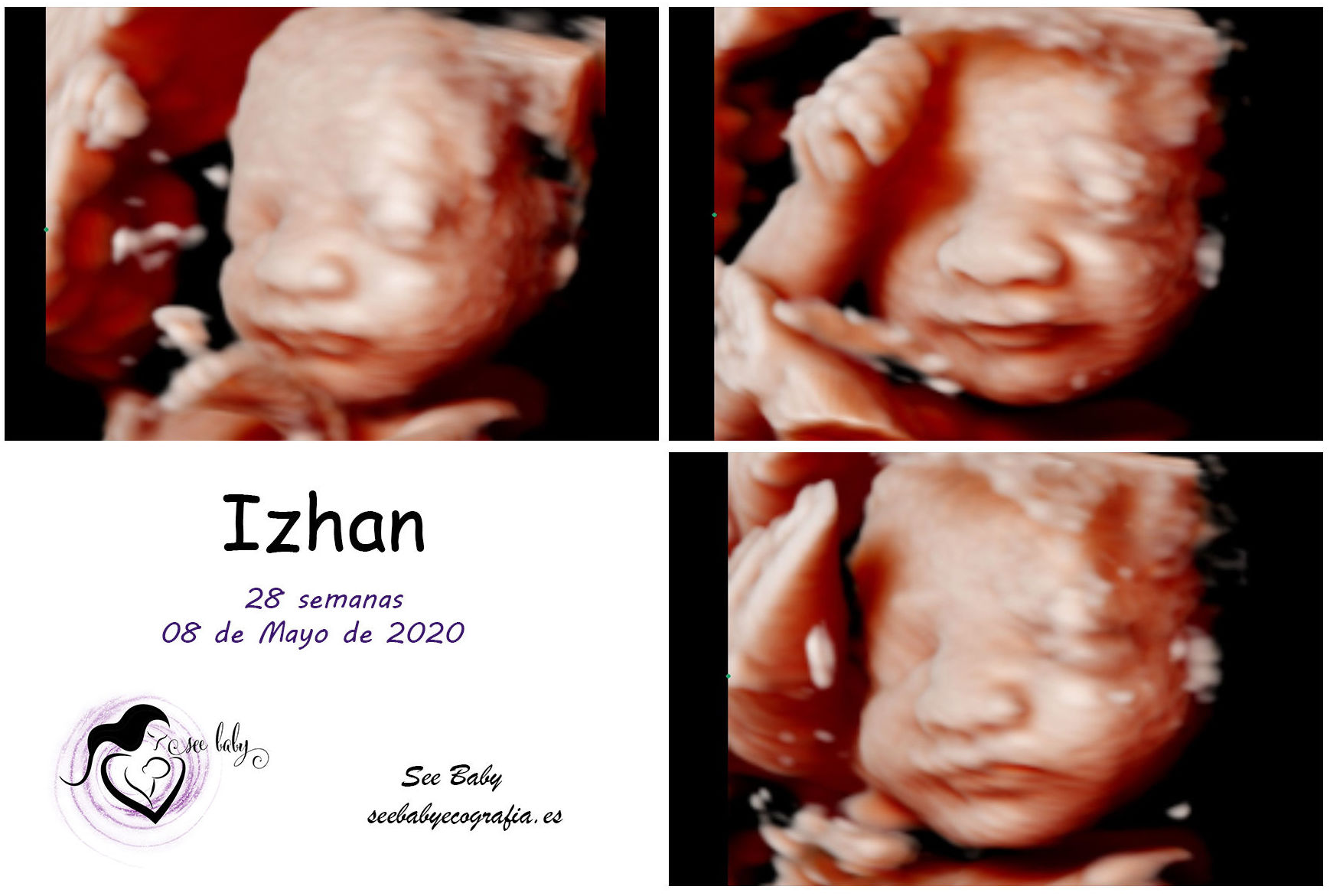 Izhan en SeeBaby Ecografia 5D